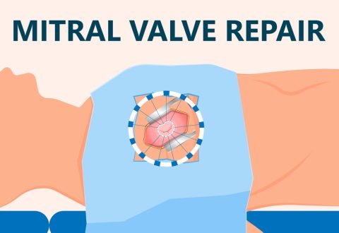 Asd,Vsd,Afib,Exam,Hole,Leak,Pain,Tavi,Tavr,Based